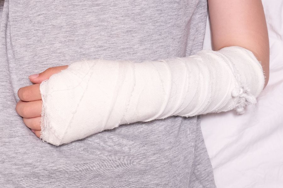 A child's arm in a plaster cast